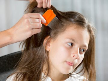 lice removal los angeles