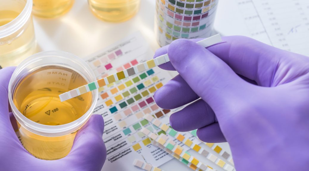 urine drug testing products