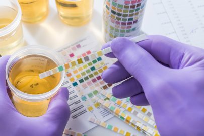 urine drug testing products